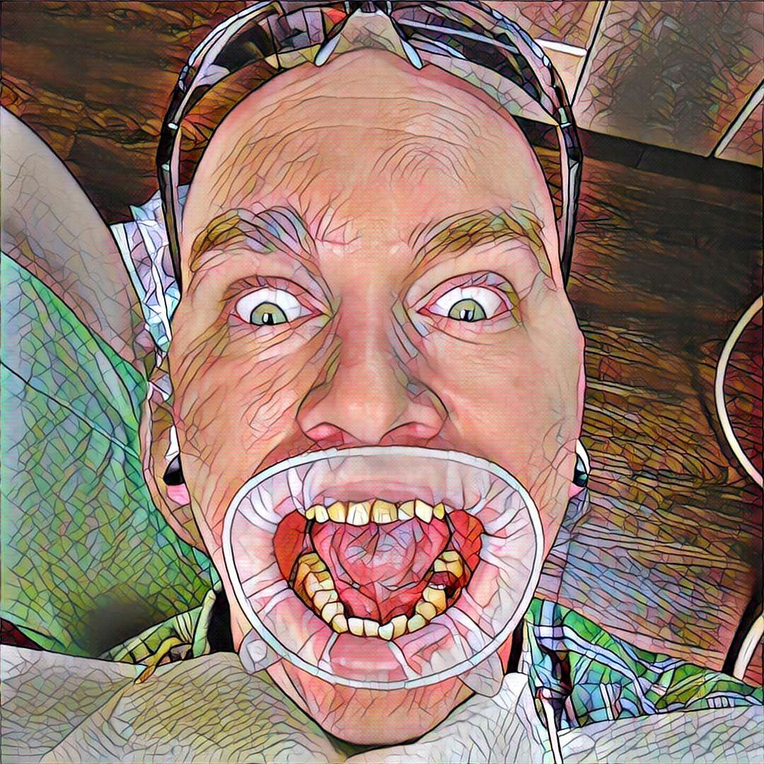 Me at the dentist with a Prisma filter